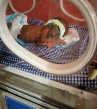 Lagos hospital successfully manages 700g pre-term baby