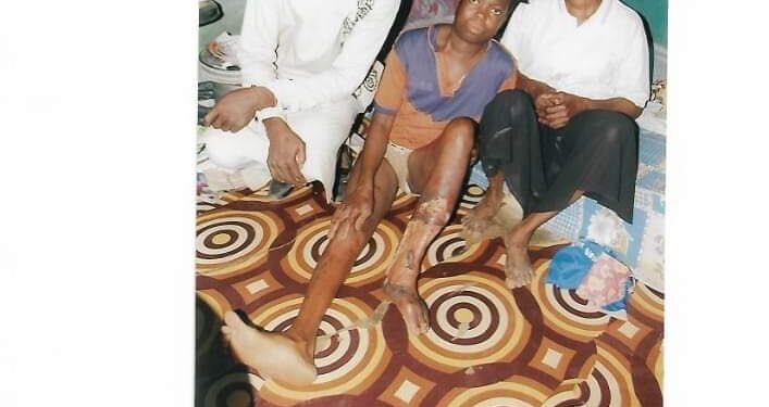 PLEASE HELP!!! Pathetic fate of ailing Fatimoh, needs 10M for surgery