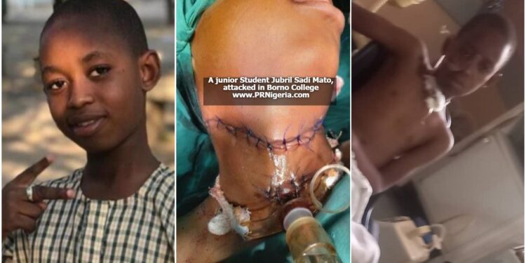 How Senior Student Brutalized 11-Year-Old Junior with Razor in Borno College