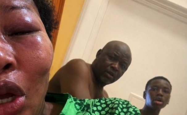 “I Still Love My Daughter” — Ilebaye’s Father Breaks Silence on Viral Family Clash
